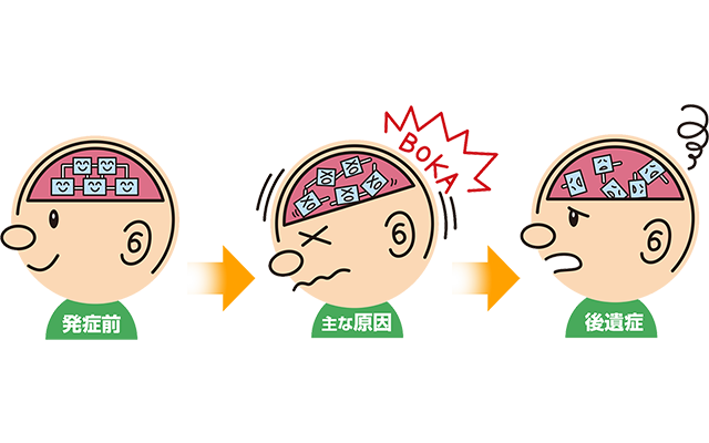 高次脳機能障害