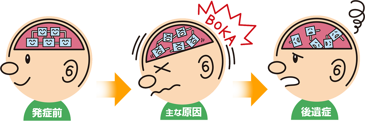 高次脳機能障害サポートネットひろしま